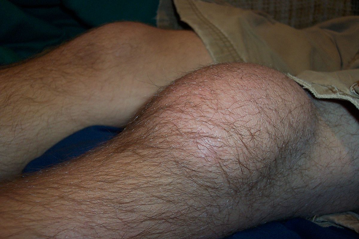 water on the knee